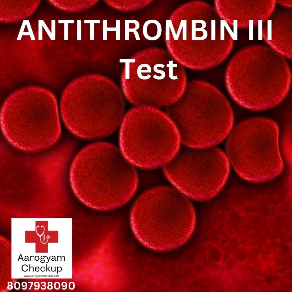 ANTITHROMBIN III Test