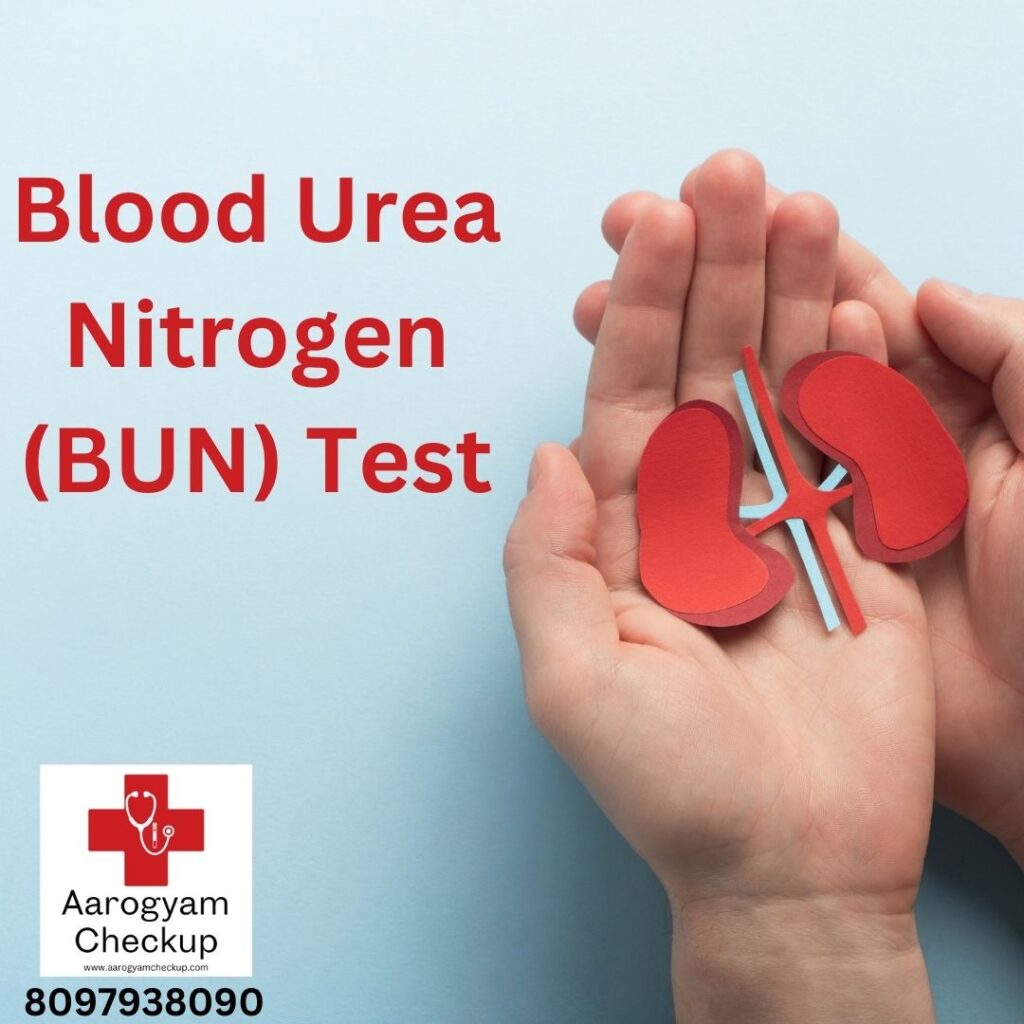 Blood Urea Nitrogen (BUN) Test