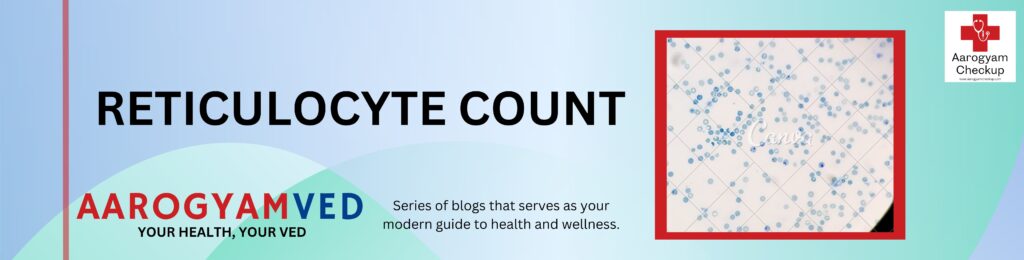 RETICULOCYTE COUNT