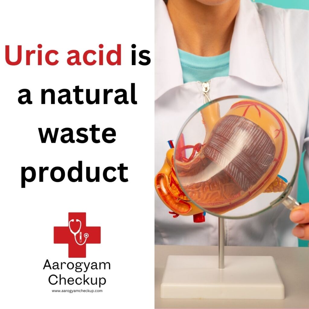 URIC ACID