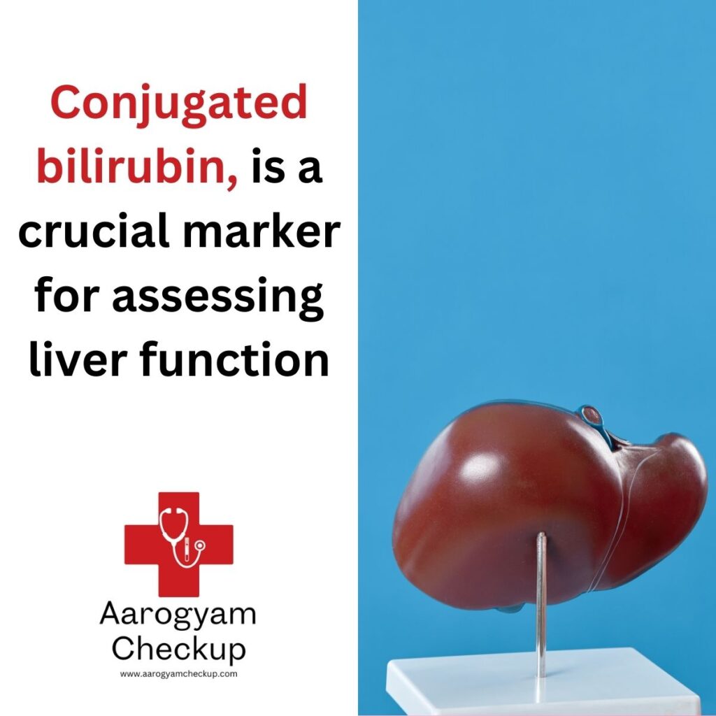 Direct Bilirubin Test