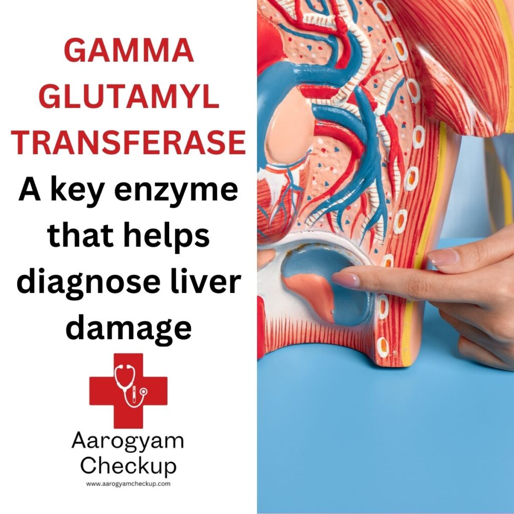 GAMMA GLUTAMYL TRANSFERASE