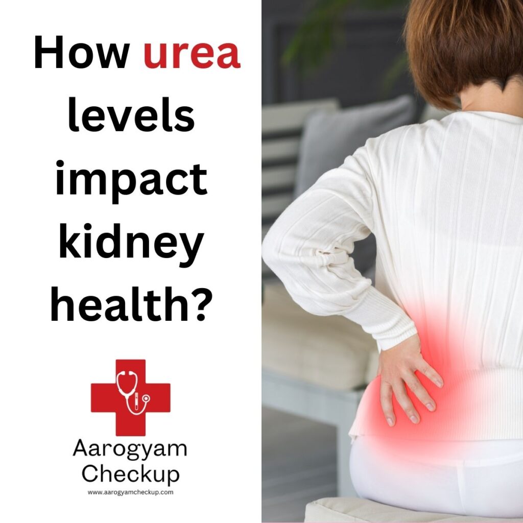 Urea Test