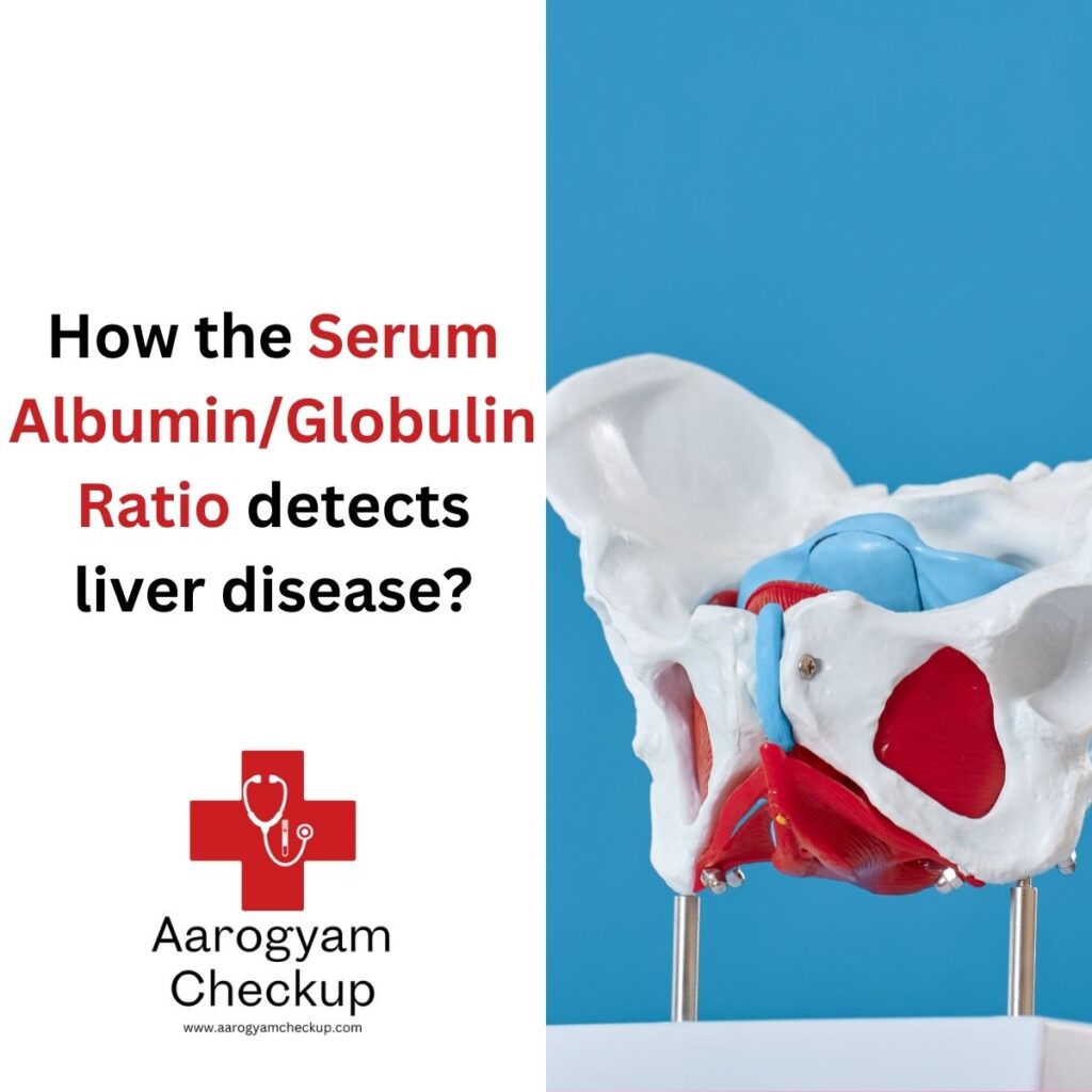 Serum Albumin/Globulin Ratio